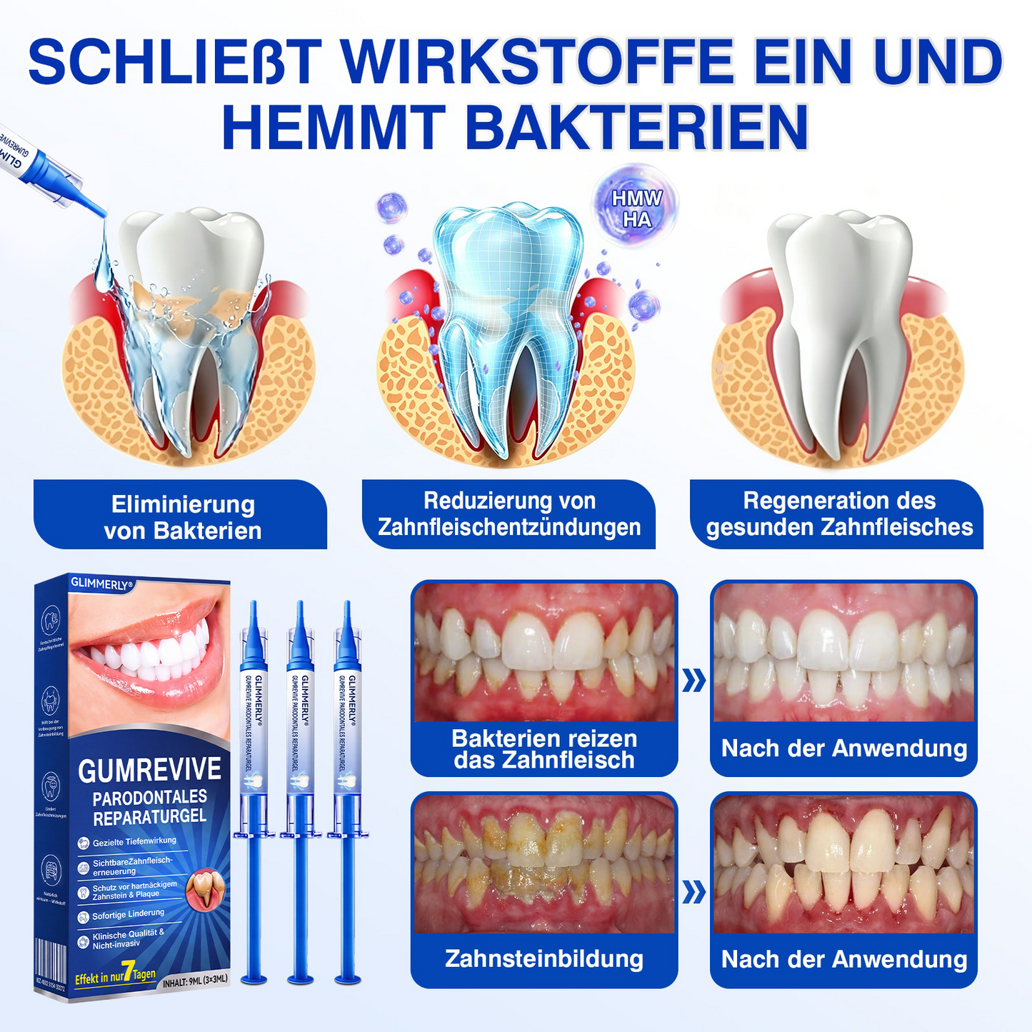 🦷𝑮𝒍𝒊𝒎𝒎𝒆𝒓𝒍𝒚®𝑮𝒖𝒎𝑹𝒆𝒗𝒊𝒗𝒆 𝑷𝒂𝒓𝒐𝒅𝒐𝒏𝒕𝒂𝒍𝒆𝒔 𝑹𝒆𝒑𝒂𝒓𝒂𝒕𝒖𝒓𝒈𝒆𝒍.