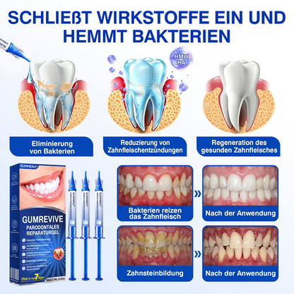 🦷𝑮𝒍𝒊𝒎𝒎𝒆𝒓𝒍𝒚®𝑮𝒖𝒎𝑹𝒆𝒗𝒊𝒗𝒆 𝑷𝒂𝒓𝒐𝒅𝒐𝒏𝒕𝒂𝒍𝒆𝒔 𝑹𝒆𝒑𝒂𝒓𝒂𝒕𝒖𝒓𝒈𝒆𝒍.