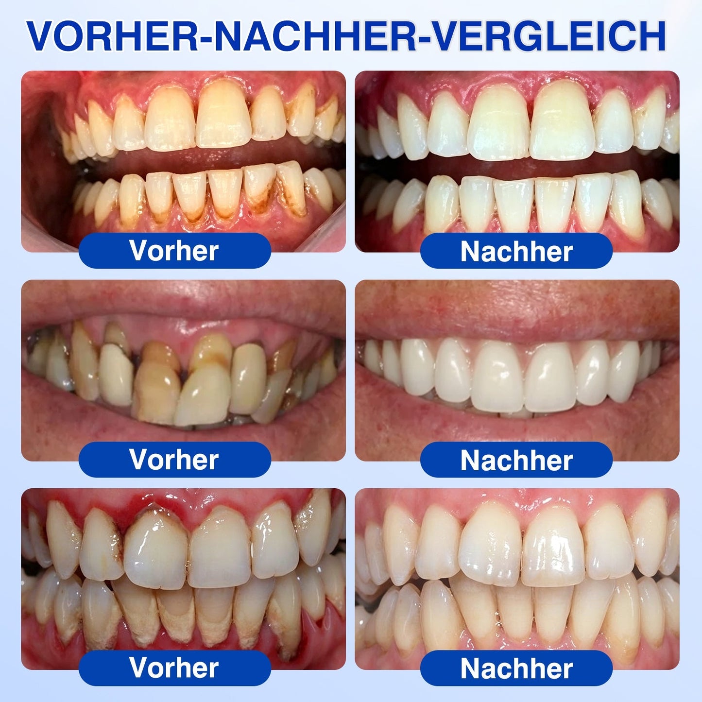 🦷𝑮𝒍𝒊𝒎𝒎𝒆𝒓𝒍𝒚®𝑮𝒖𝒎𝑹𝒆𝒗𝒊𝒗𝒆 𝑷𝒂𝒓𝒐𝒅𝒐𝒏𝒕𝒂𝒍𝒆𝒔 𝑹𝒆𝒑𝒂𝒓𝒂𝒕𝒖𝒓𝒈𝒆𝒍.