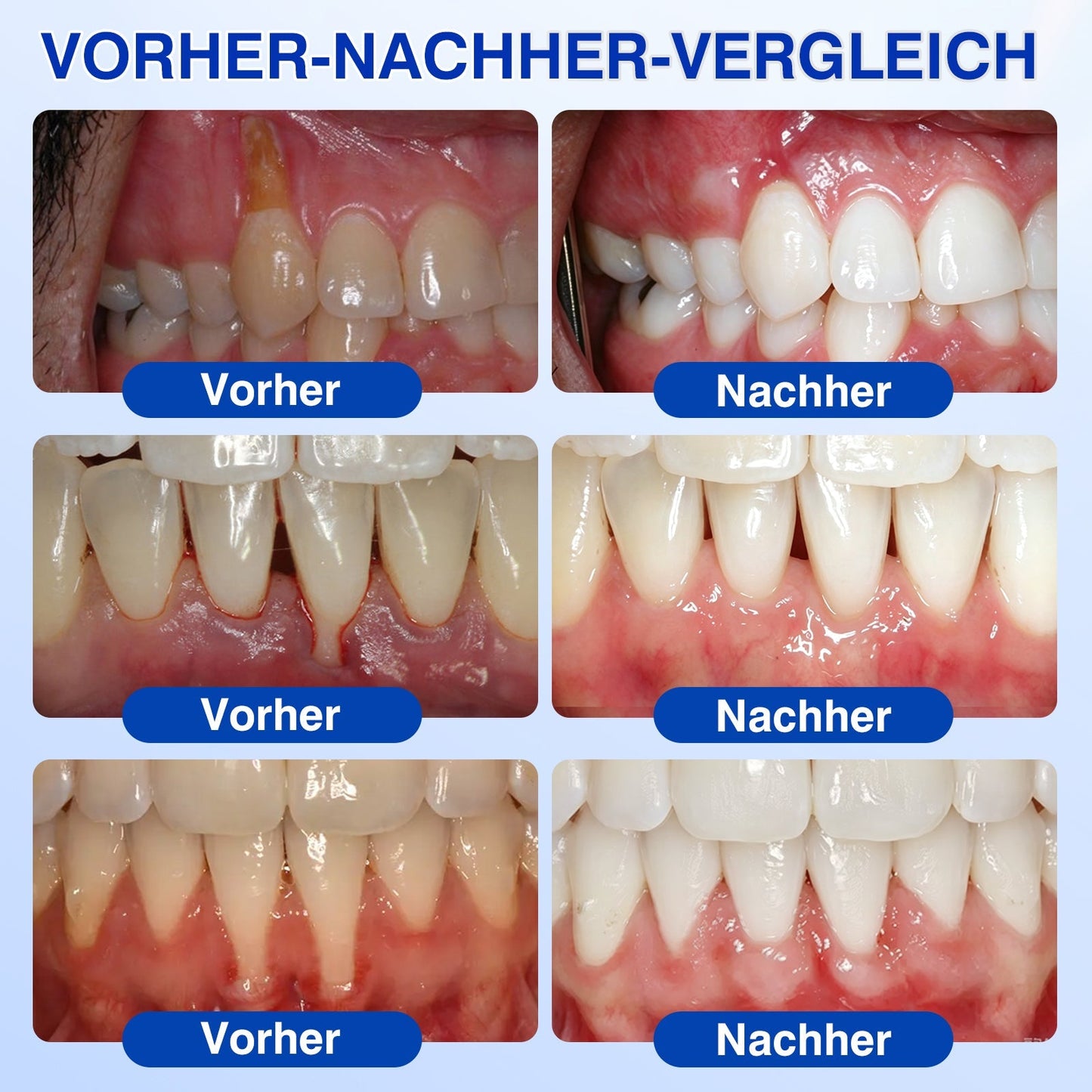 🦷𝑮𝒍𝒊𝒎𝒎𝒆𝒓𝒍𝒚®𝑮𝒖𝒎𝑹𝒆𝒗𝒊𝒗𝒆 𝑷𝒂𝒓𝒐𝒅𝒐𝒏𝒕𝒂𝒍𝒆𝒔 𝑹𝒆𝒑𝒂𝒓𝒂𝒕𝒖𝒓𝒈𝒆𝒍.