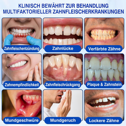 🦷𝑮𝒍𝒊𝒎𝒎𝒆𝒓𝒍𝒚®𝑮𝒖𝒎𝑹𝒆𝒗𝒊𝒗𝒆 𝑷𝒂𝒓𝒐𝒅𝒐𝒏𝒕𝒂𝒍𝒆𝒔 𝑹𝒆𝒑𝒂𝒓𝒂𝒕𝒖𝒓𝒈𝒆𝒍.