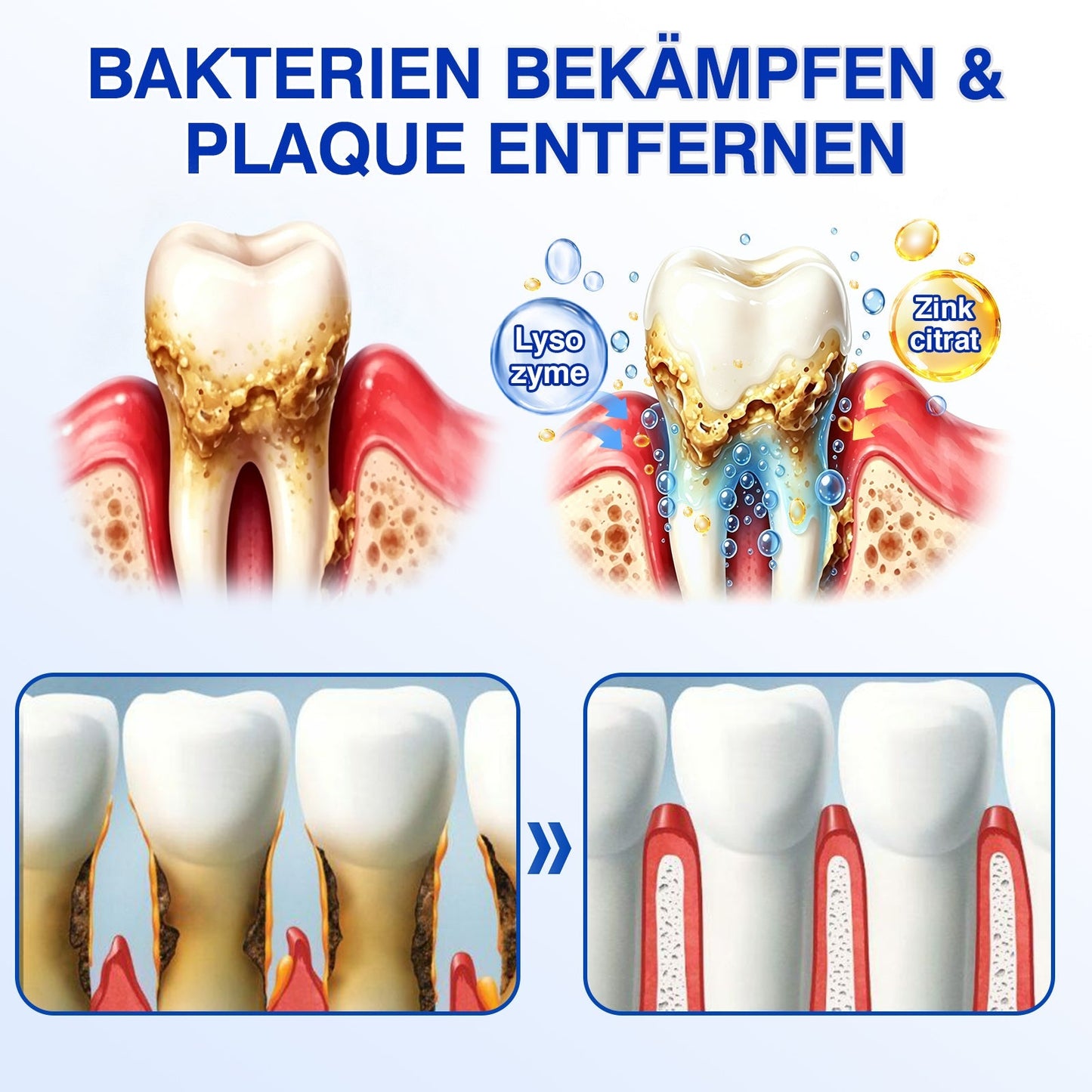 🦷𝑮𝒍𝒊𝒎𝒎𝒆𝒓𝒍𝒚®𝑮𝒖𝒎𝑹𝒆𝒗𝒊𝒗𝒆 𝑷𝒂𝒓𝒐𝒅𝒐𝒏𝒕𝒂𝒍𝒆𝒔 𝑹𝒆𝒑𝒂𝒓𝒂𝒕𝒖𝒓𝒈𝒆𝒍.